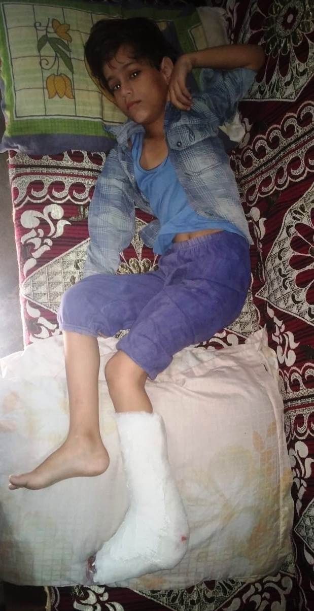 Hathras: The roof of the house fell due to rain, girl injured