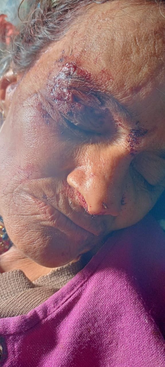 Woman injured in bear attack