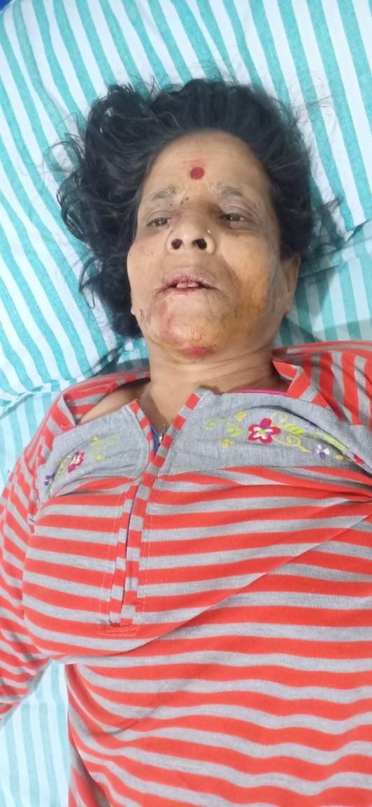 Elephant attacked women