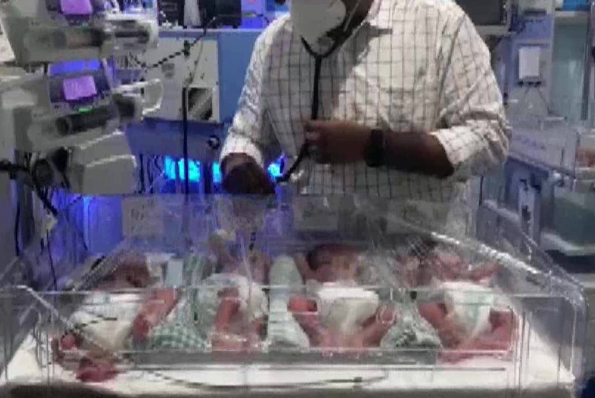 27 year old woman gives birth to quadruplets in Hyderabad Latest News Update