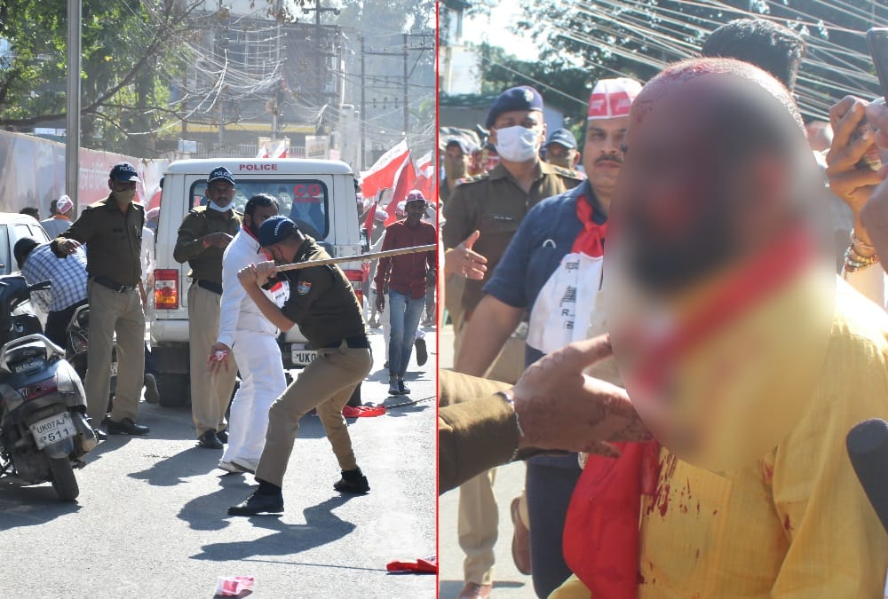 Dehradun News: Police Lathi charge on Rashtriya Janlok Party workers during secretariat march photos