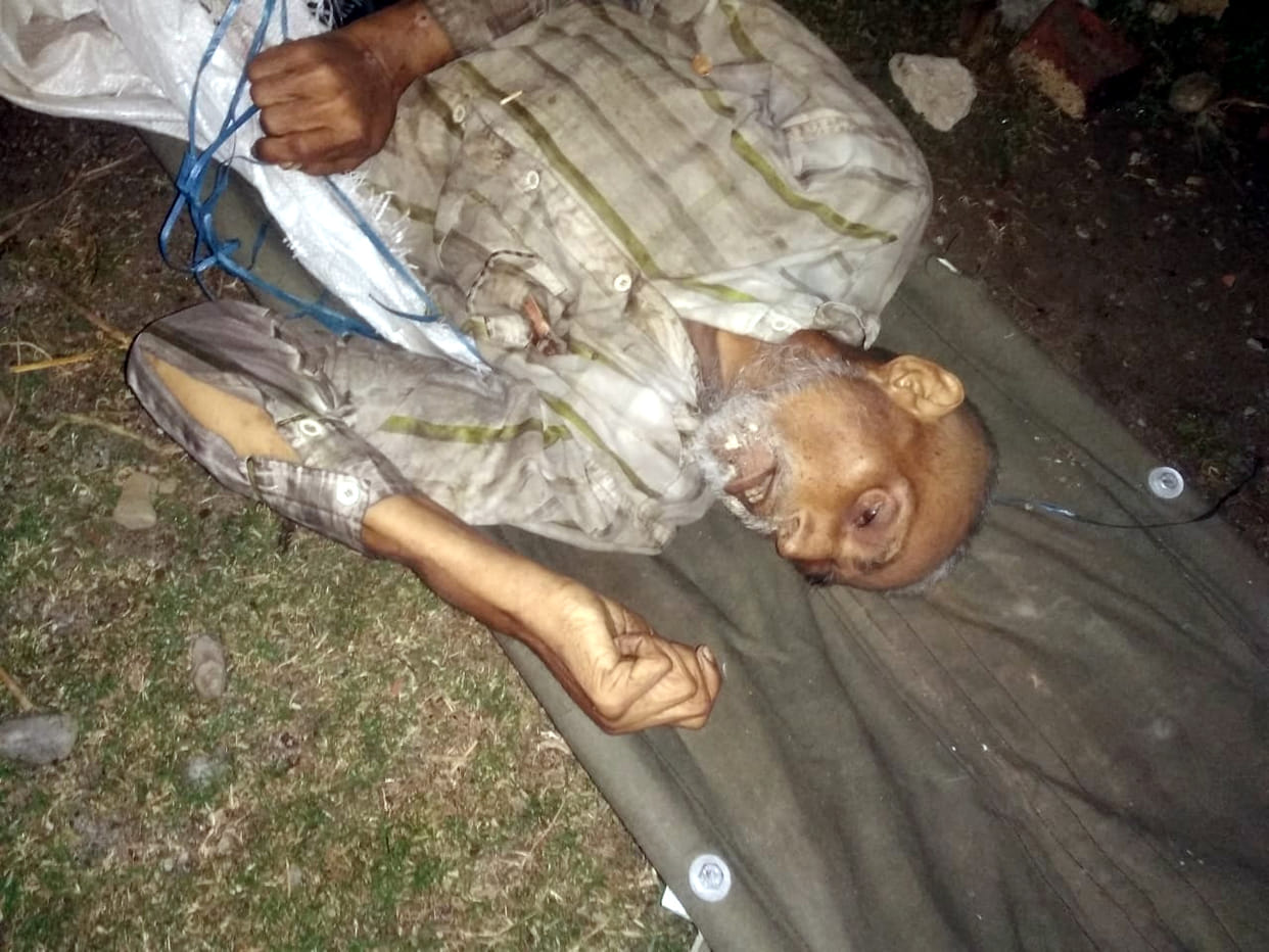 Dead body