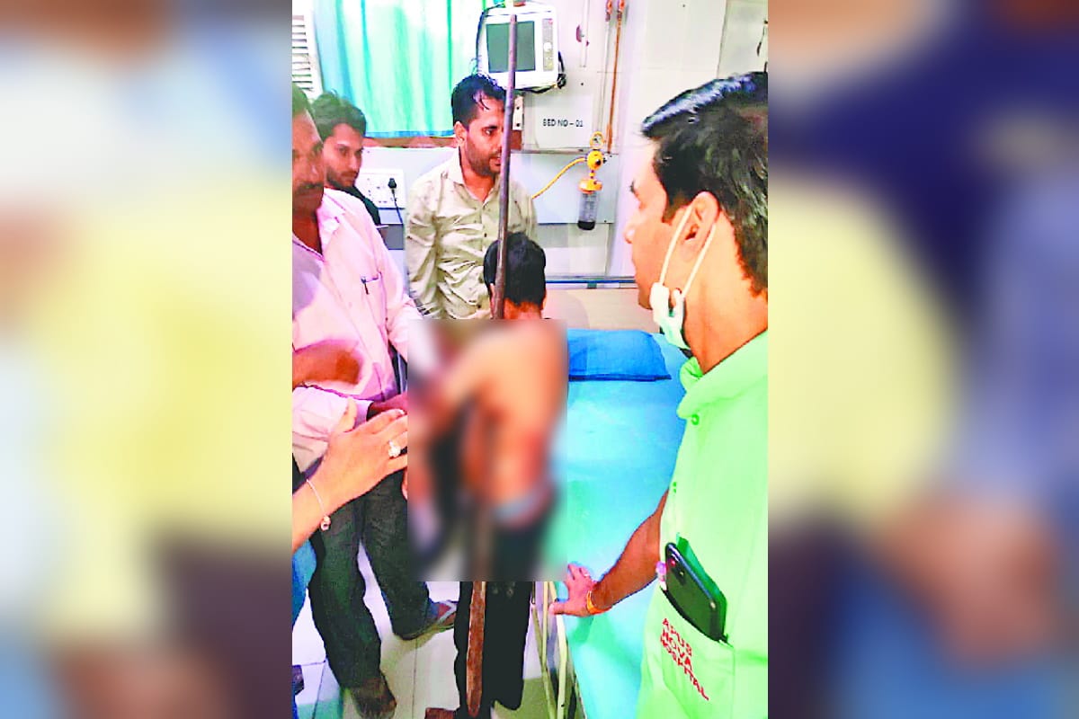UP News: A 12-year-old boy got bamboo in his shoulder and had a successful operation in three hours in Meerut