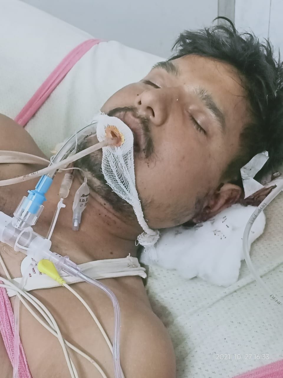 Hathras: Uncle injured nephew by shoveling