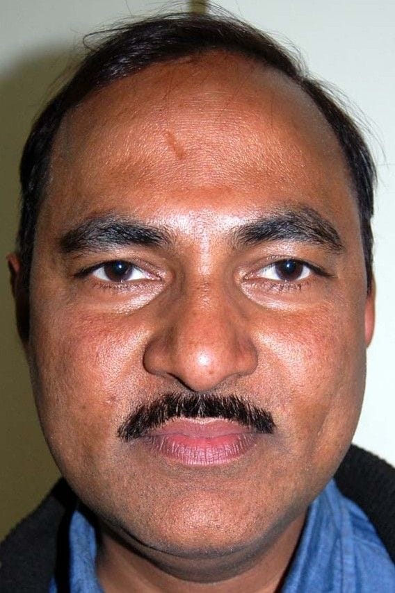 Hathras: Former MP wrote letter to fix Hathras Jalesar road