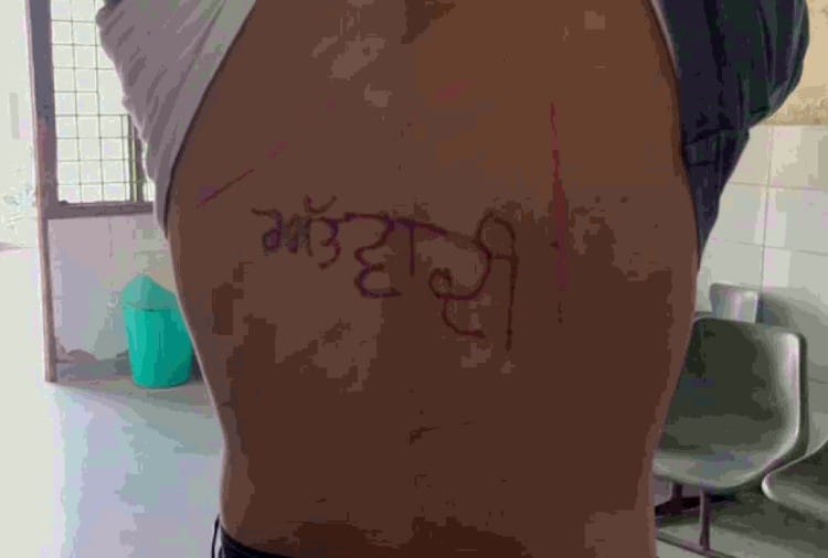 Prisoner accuses Barnala jail administration of beating and writing terrorist on the back