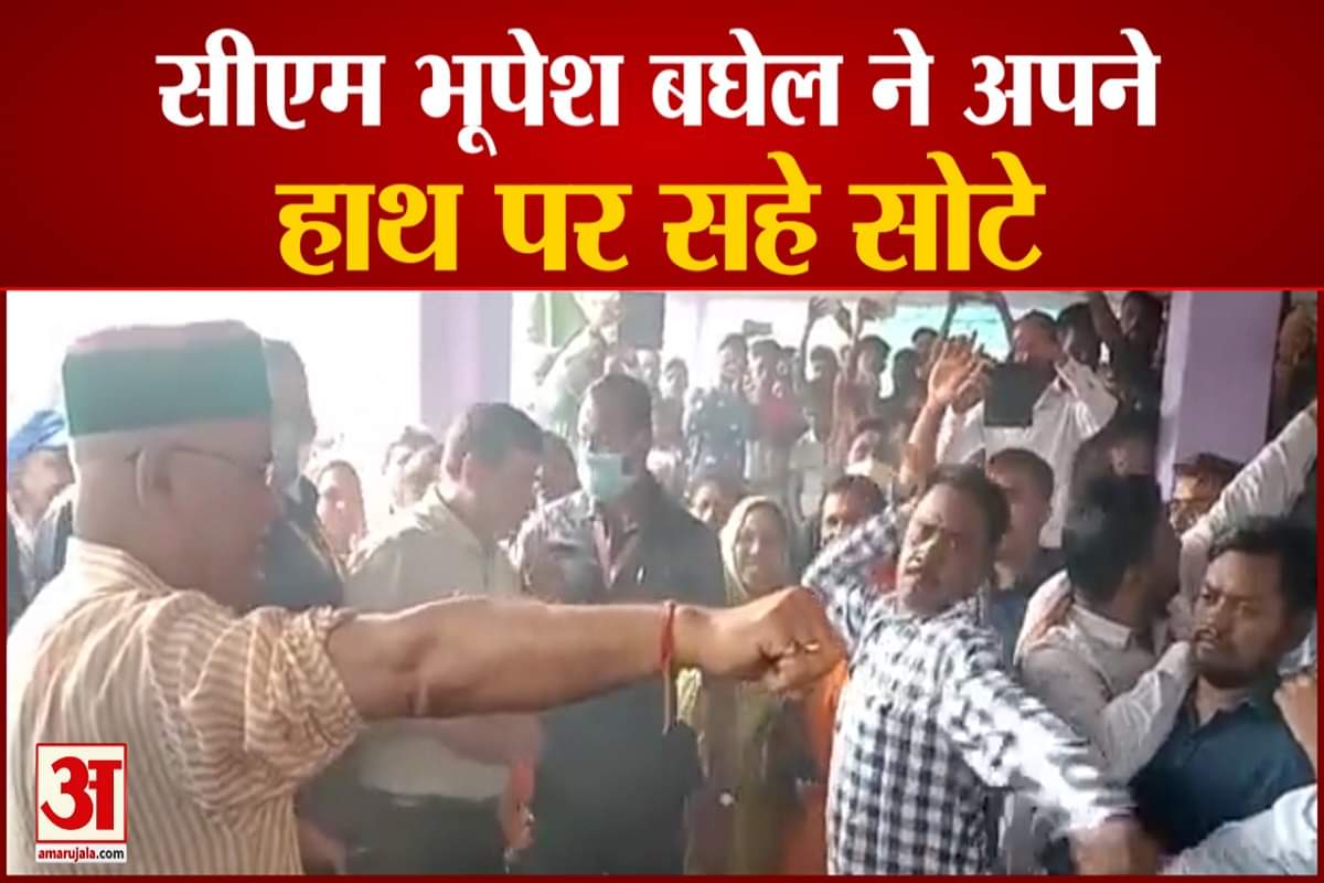 भूपेश बघेल ने अपने हाथ पर सहे सोटे