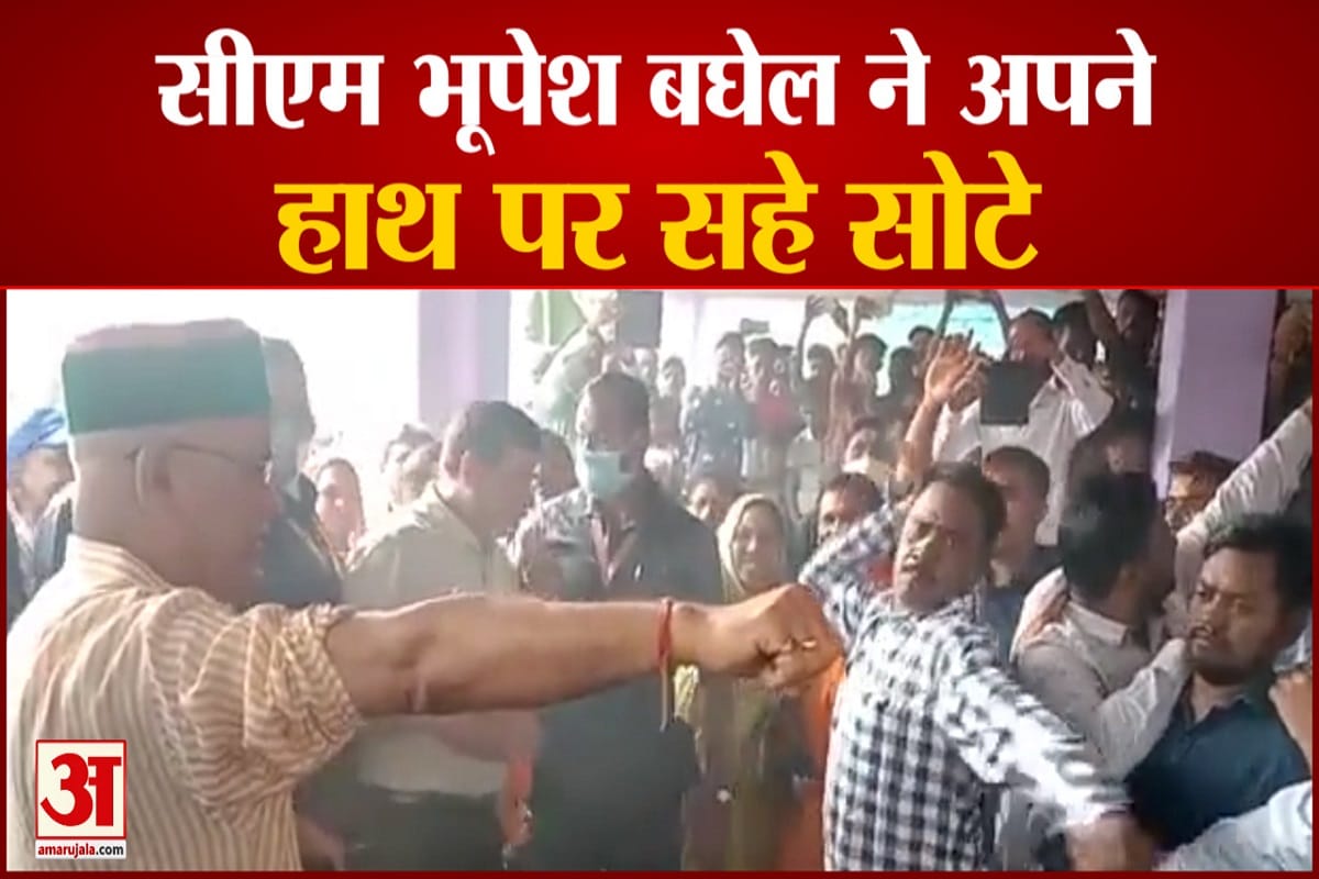 भूपेश बघेल ने अपने हाथ पर सहे सोटे
