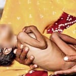 कुपोषित बच्चे(सांकेतिक)