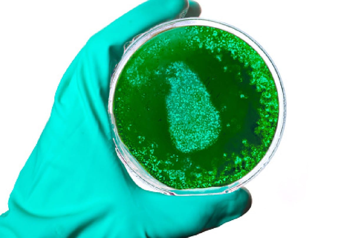 Brain eating fungus is hunting from humans to dolphins know the surprising things about it