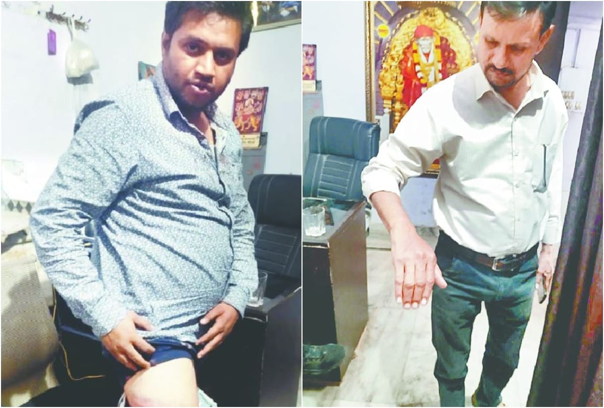 Two Businessman Beat In Kamala Nagar Police Station Crime News