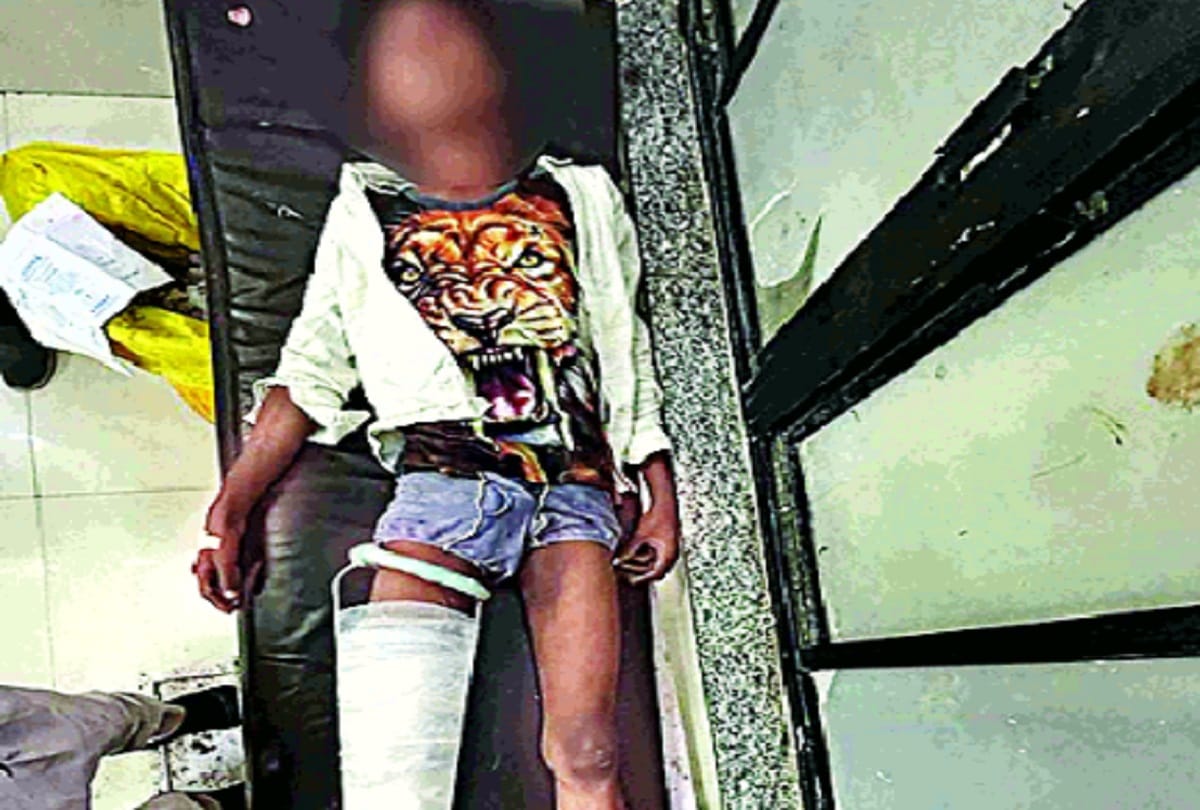 Inhumanity with woman in Bawana lover acid poured with tied hands condition critical