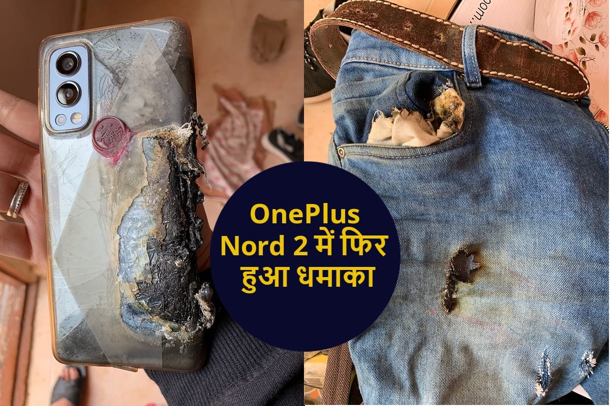 Another OnePlus Nord 2 blasts user receives severe burns
