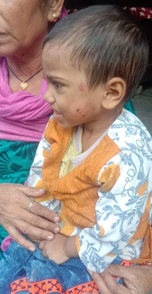 Mother summoned to Child Welfare Committee office for torturing the girl