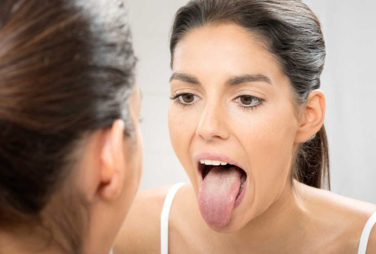 change in tongue colour means, know what expert says about this