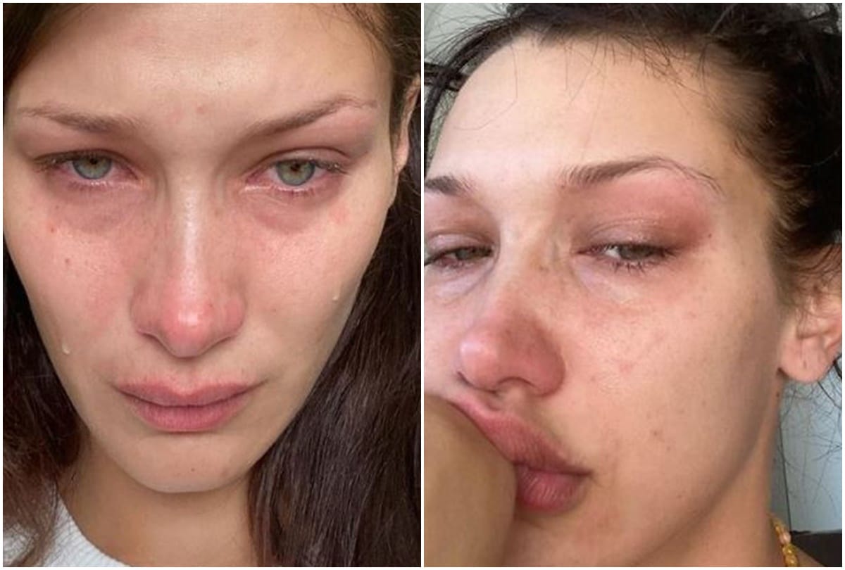 Bella hadid share her crying photos on social media talk about burnouts and breakdown