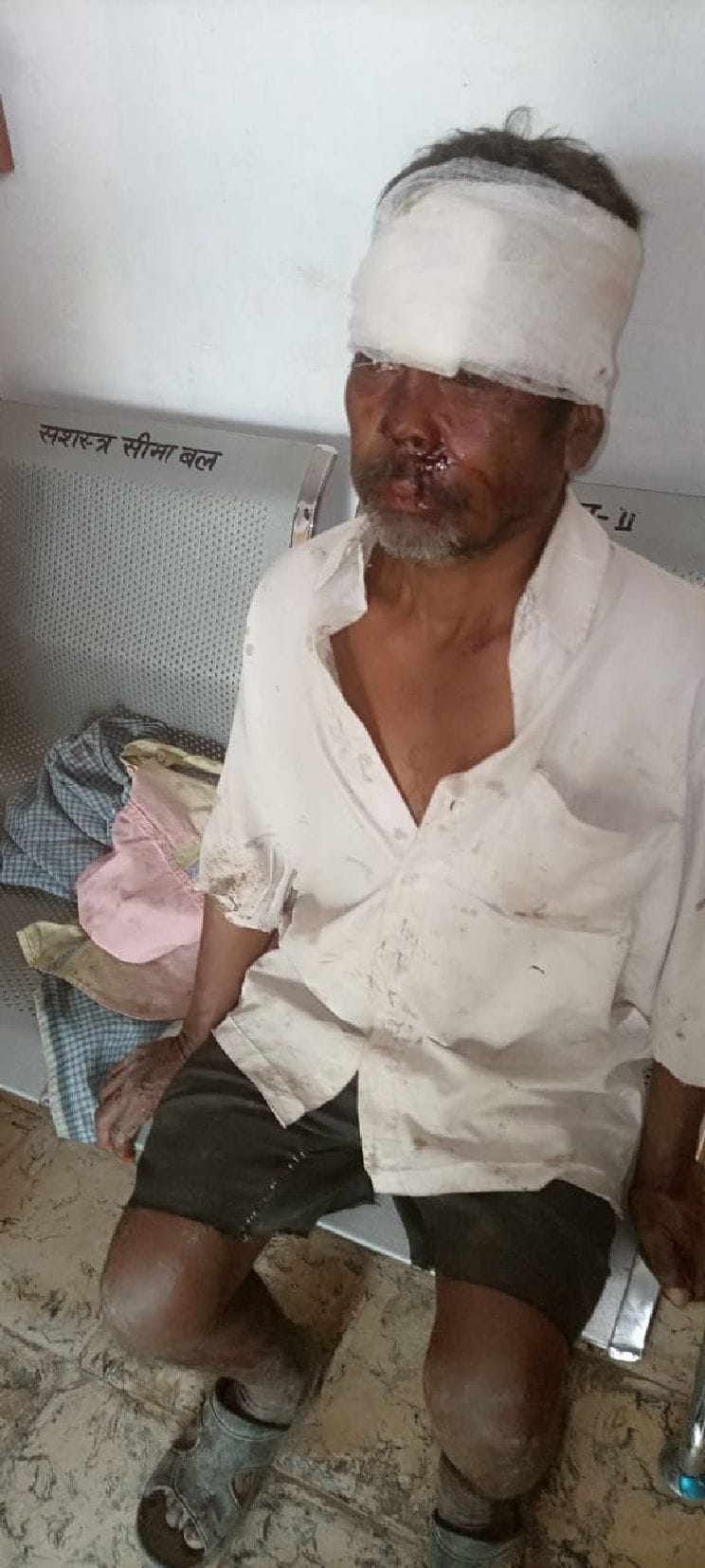 A young man clashed with a leopard to save his life, injured