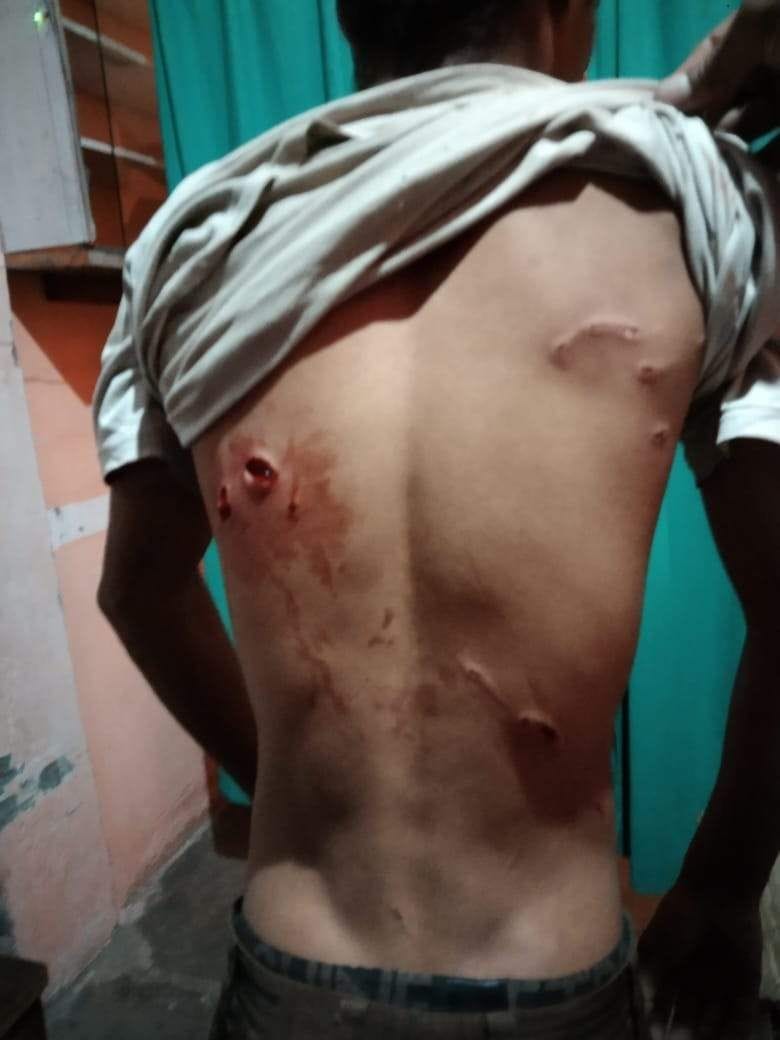 student injured in monkey attack