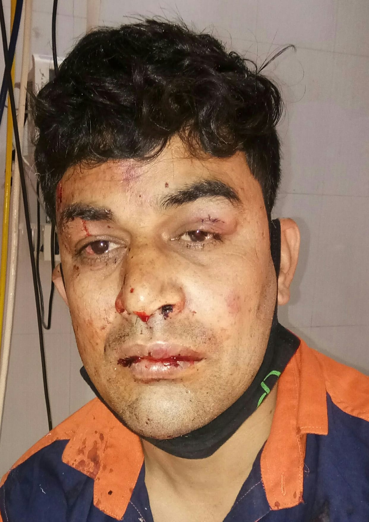 Four injured in truck-car collision