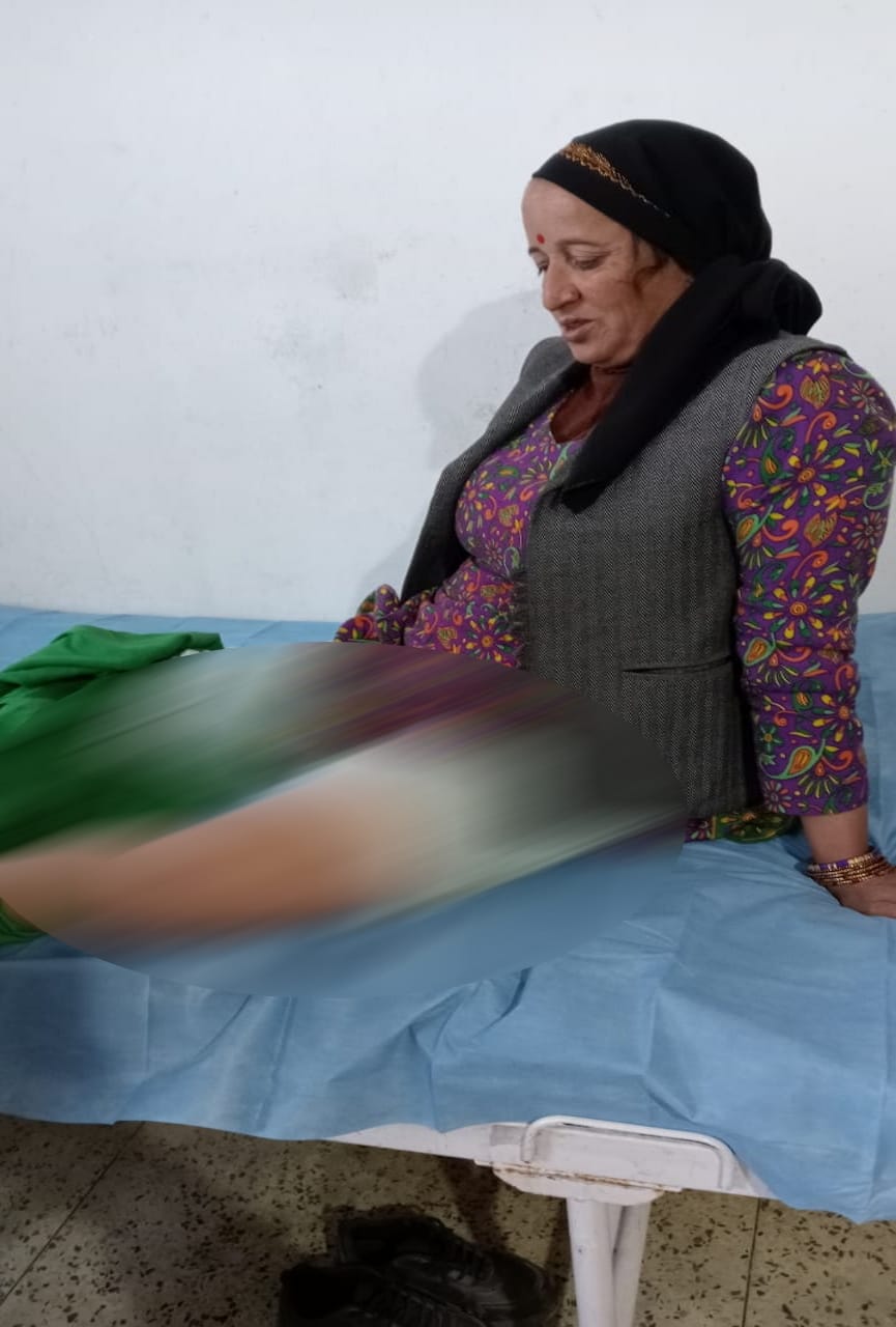 uttarakhand news: bear attacked on woman who went to take grass in forest