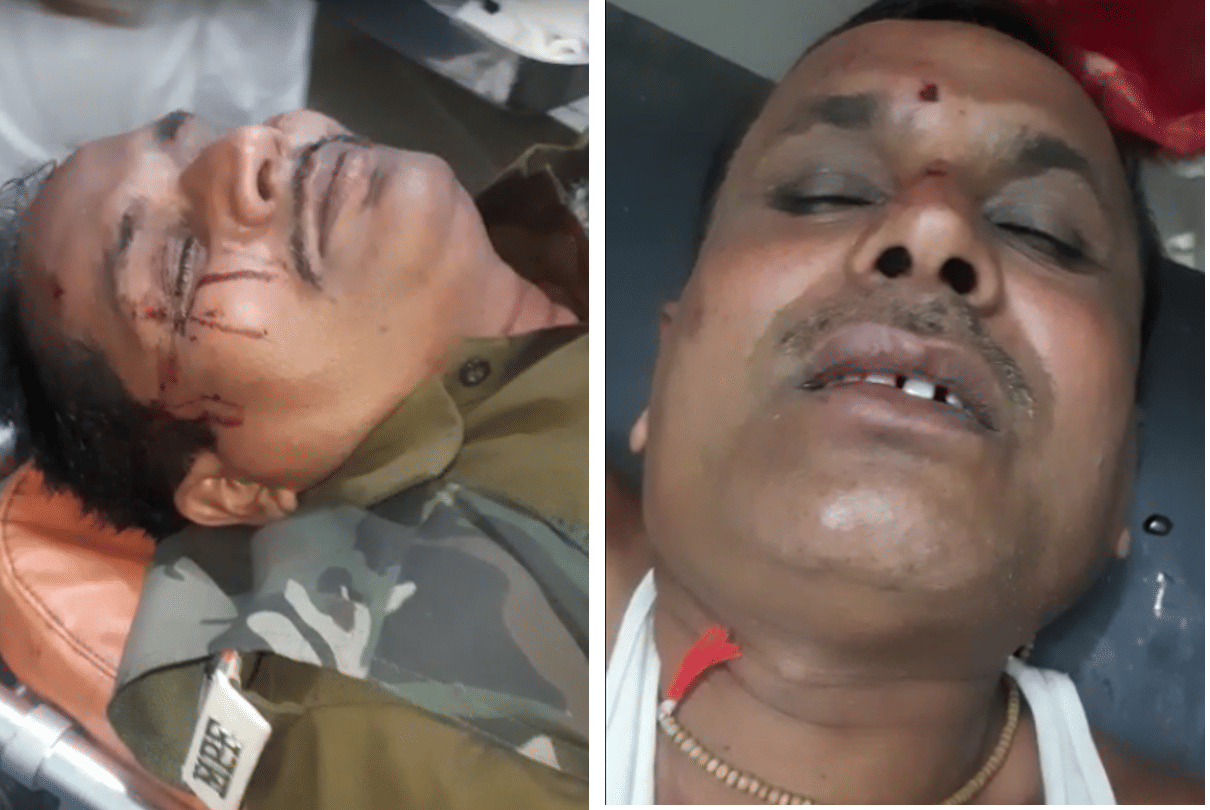 Chhatarpur: There was information about the hiding of the hyena in the field, when they arrived, the leopard attacked, two deputy rangers injured