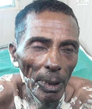 Putting petrol on the father for not giving it after buying a tractor