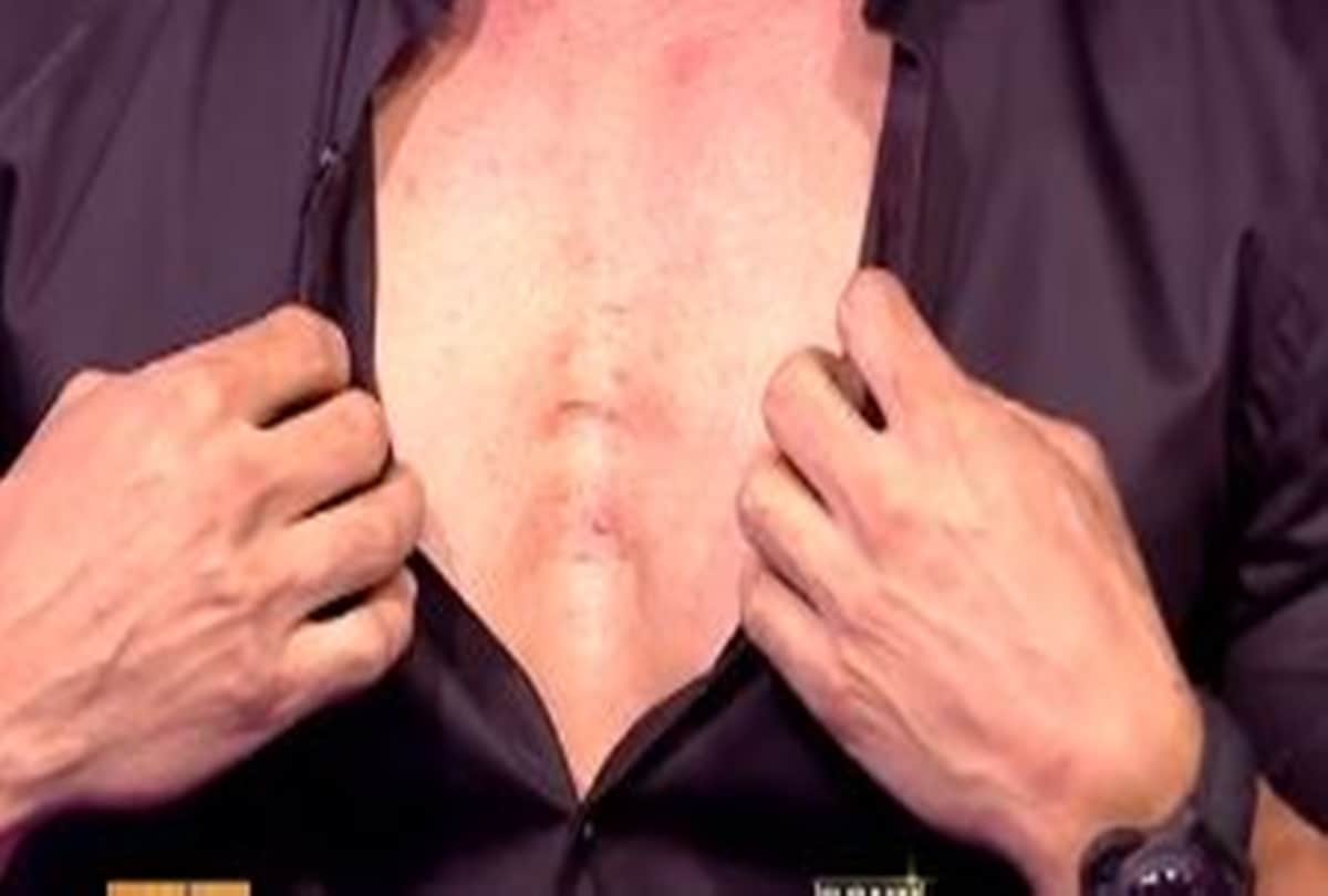 KBC 13 john abraham revealed a boxer ripped his chest apart see amitabh bachcha reaction