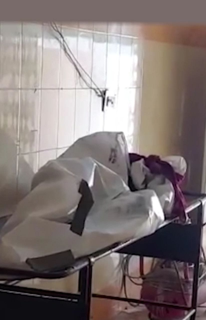 Half-burnt body of a girl found in Indore: already strangled with a dupatta, then set on fire, the upper part of the waist was burnt