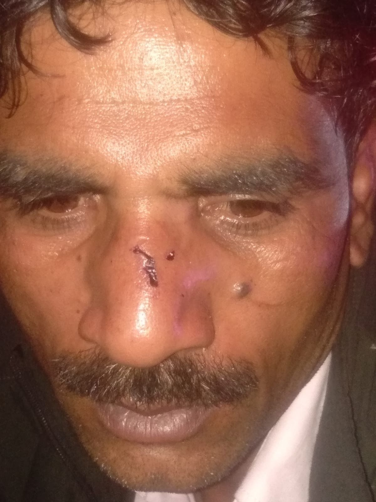 Hotel was blown up in the year 2016, now attacked for not paying extortion of five lakhs