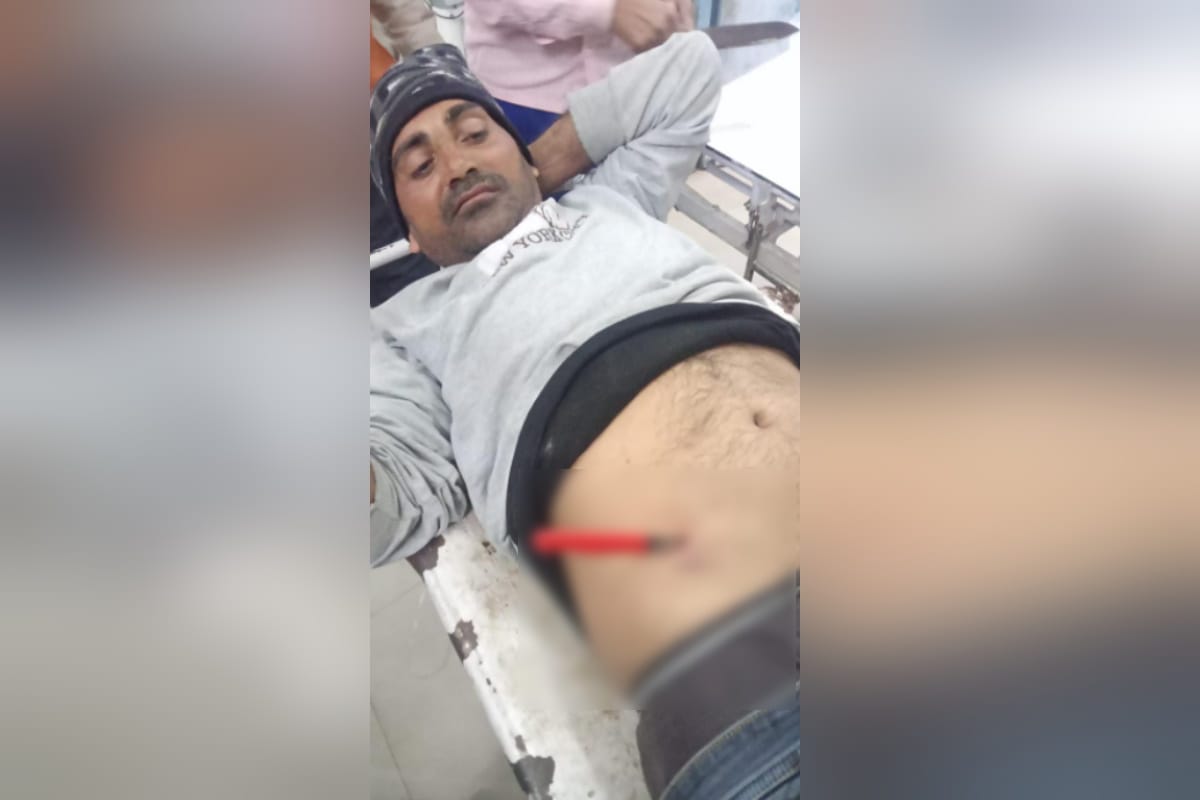 Baghpat News: A man was stabbed in the stomach and referred to Meerut by doctors