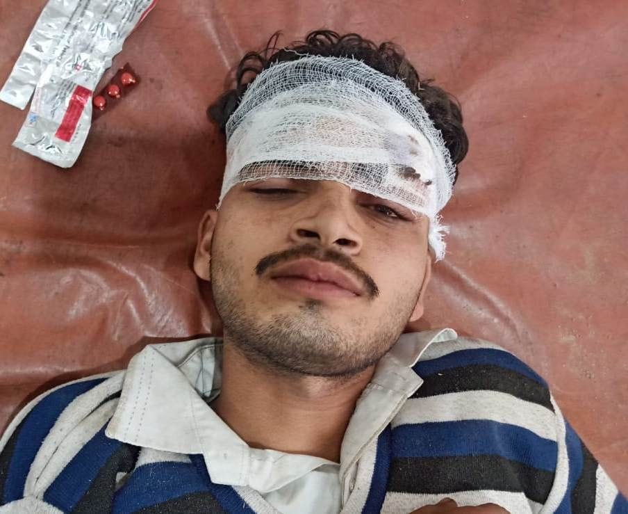 Hathras: Two people injured in a collision between a moped and a bike