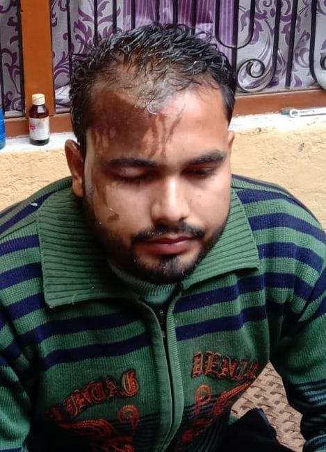 thief threw acid on trader son