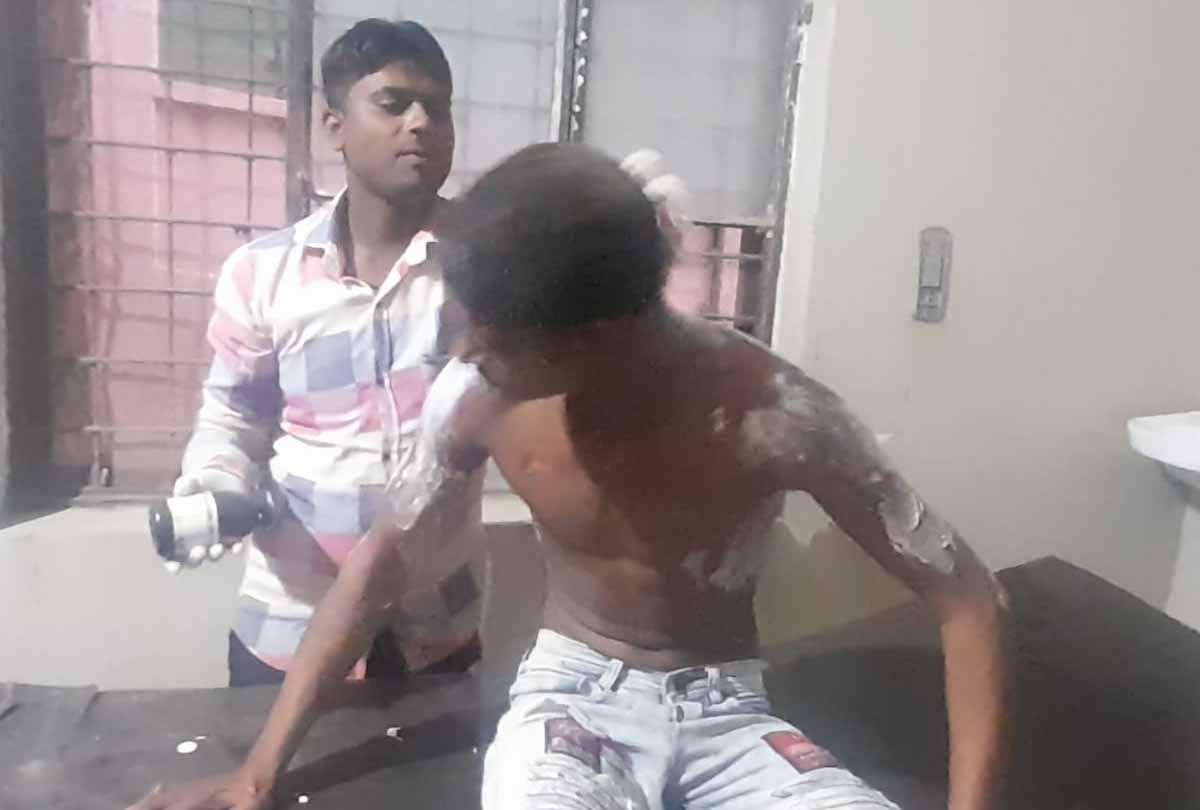 Hamirpur: Wife did not return from maternal home, husband set himself on fire, youth had tried suicide by drinking dye earlier