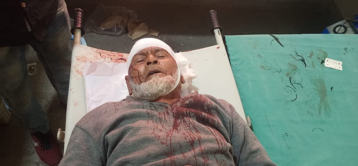 Bloody struggle while pouring sugarcane bagasse in paper mill