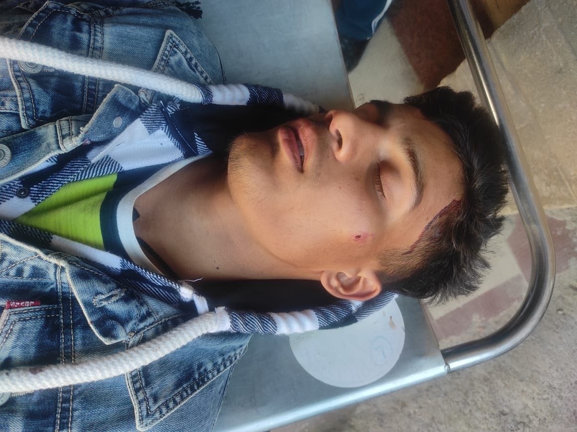 Outside youths attacked college students with weapons, two seriously injured