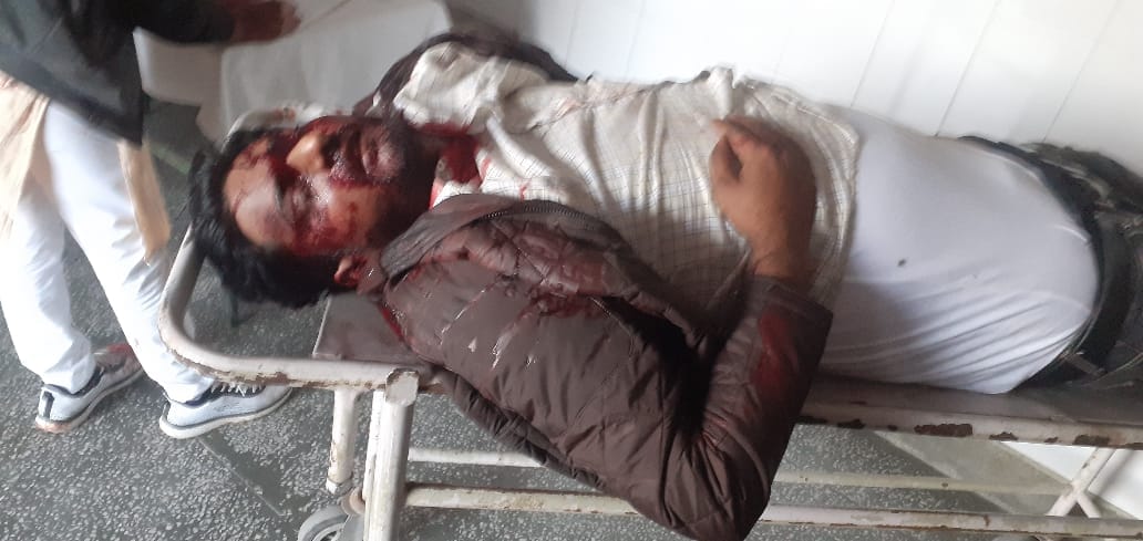 One killed, three serious in collision of three bikes