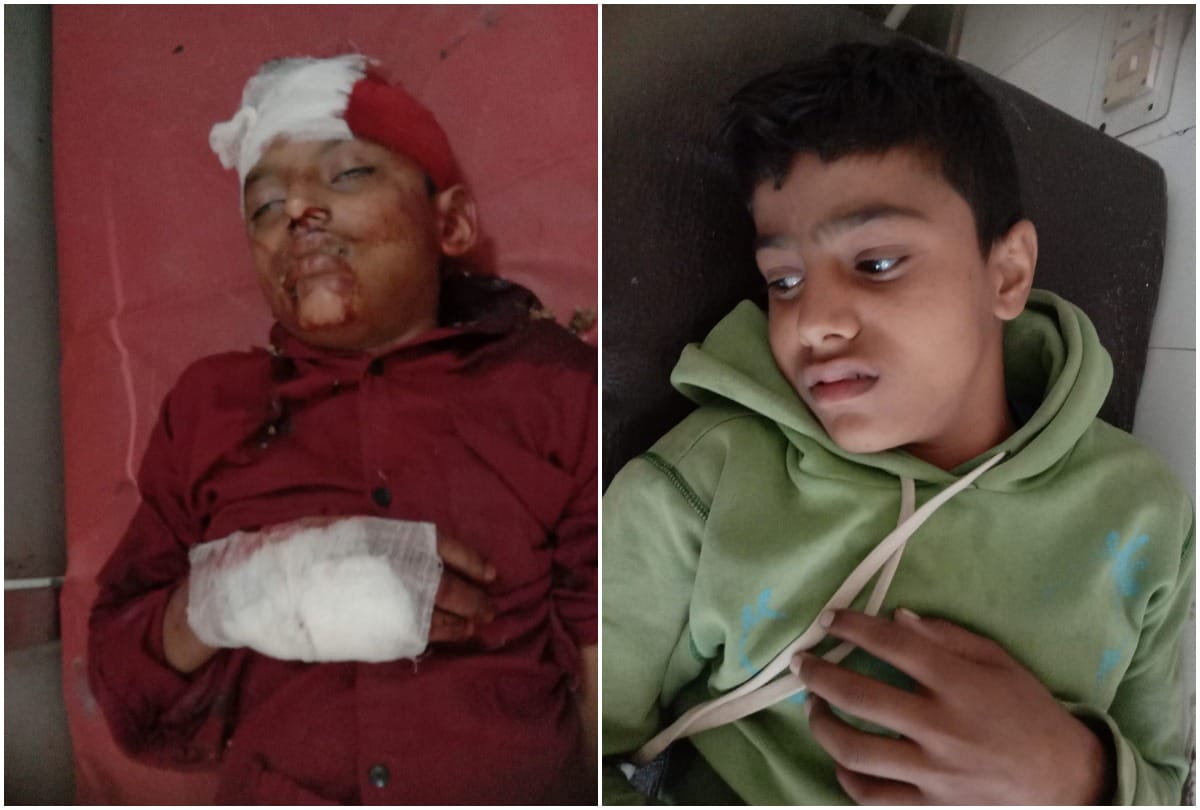 Two girl students of class 12 were scorched due to mashal falling in polling awareness rally hospitalized