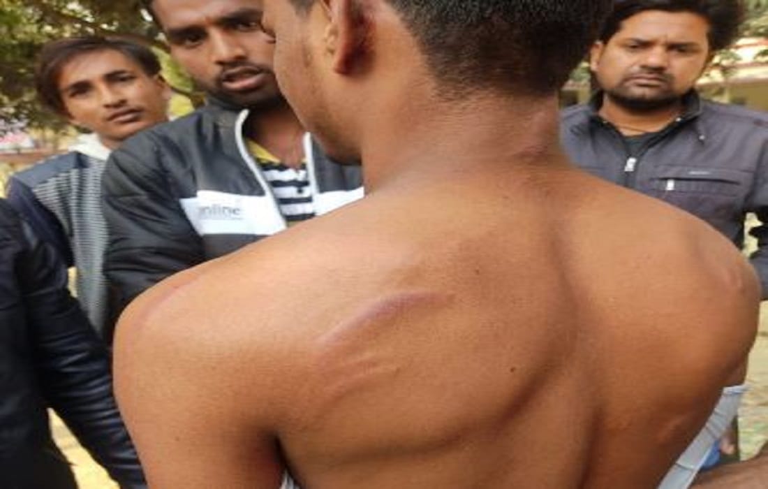 youth beaten up in jaunpur by miscreants while going for hair cutting accused of blowing dust