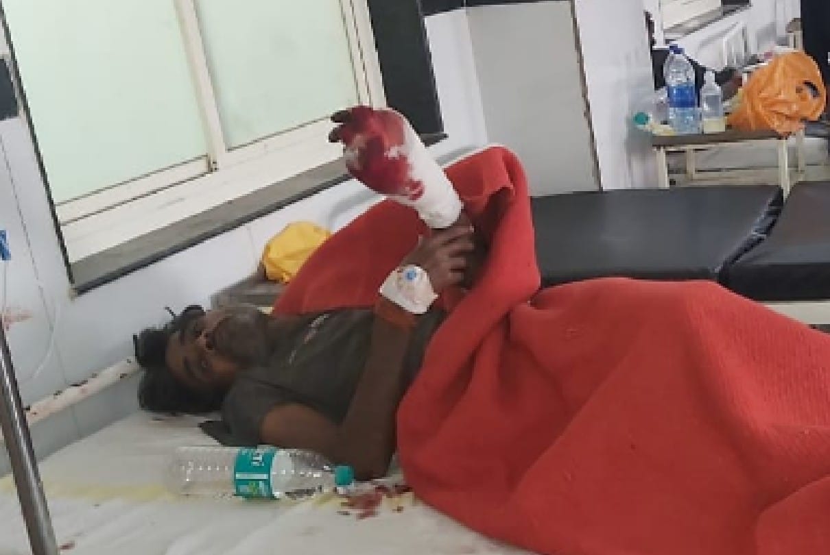 Chhatarpur: Passenger fell from Nizamuddin-Jabalpur Mahakaushal Express in panic, hands cut off after being hit by train