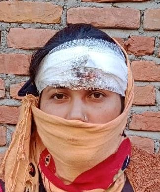 Drunk boys looted the money kept in the galley after injuring the woman shopkeeper in pithoragarh