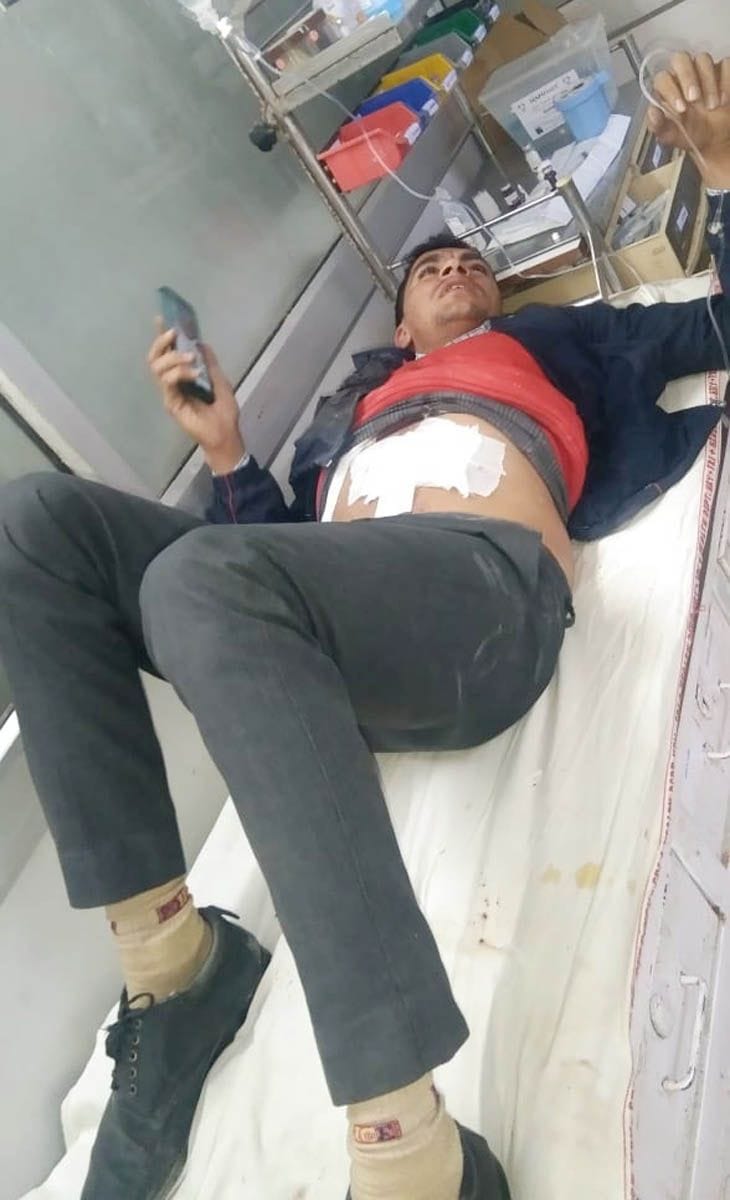 Wildlife guard injured due to shrapnel from capped gun