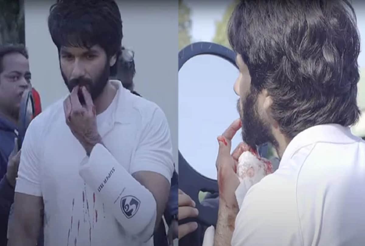 Jersey Watch Shahid bleed all over his shirt after injuring lip on sets