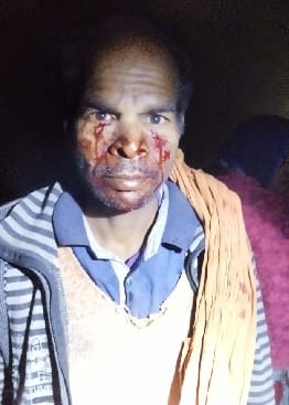A young man sleeping in a shed in Dhaurhara was injured by a wild animal