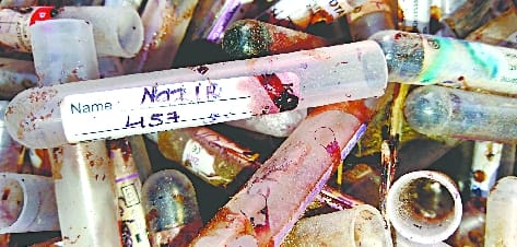Thousands of blood samples and rapid test kits were sold to the scrap