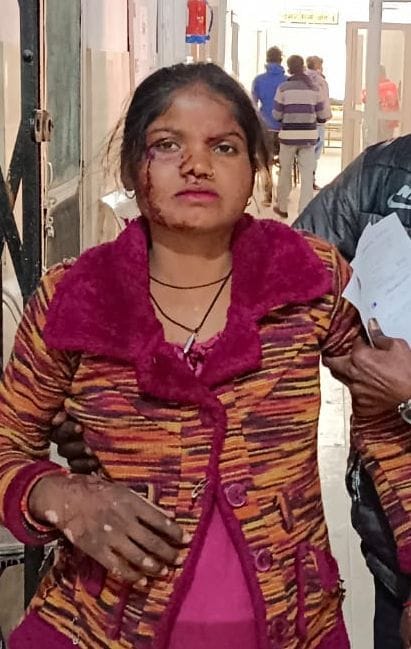 Stray dogs attacked children playing outside the house