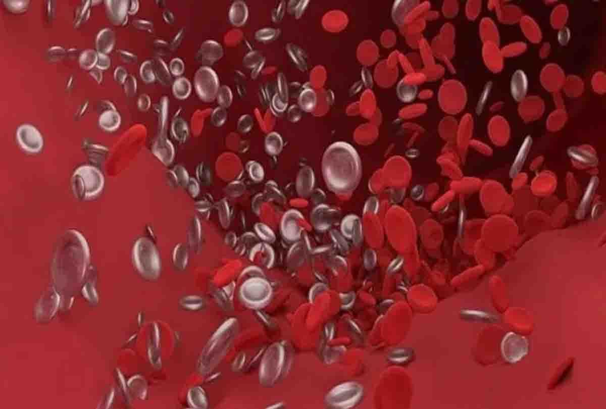 New method of vascular intervention gave relief