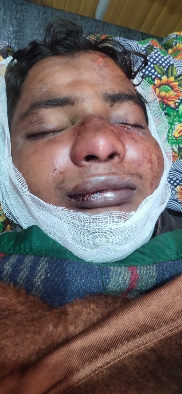 fathepur news,The shopkeeper was injured by a sharp weapon