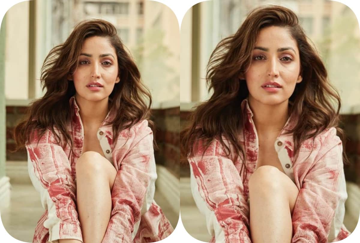 Yami Gautam on Incurable Skin Condition Keratosis Pilaris it took years to accept it and wear her confidence