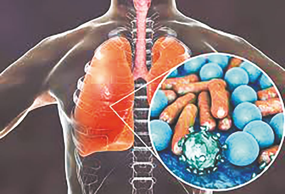 13 Covid patient found second time in december