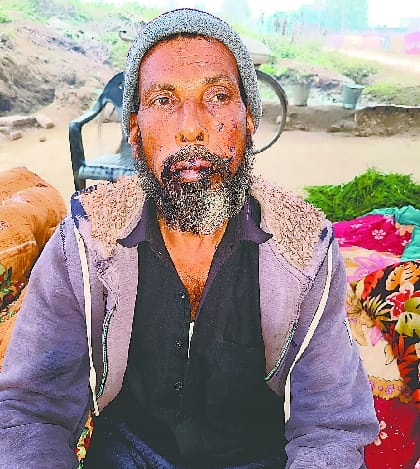 Leopard attacked and injured the kiln worker
